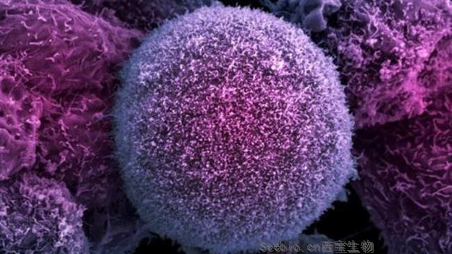 FASEB J：新研究帮助杀死原来杀不死的癌细胞