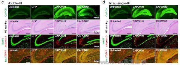 Nat Commun：阿尔兹海默症病理蛋白与小鼠的<font color='red'>细胞死亡</font>有关