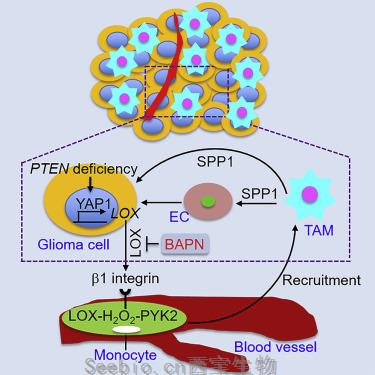 Cancer Cell：揭示巨噬细胞支持PTEN缺陷胶质母细胞瘤的机制！