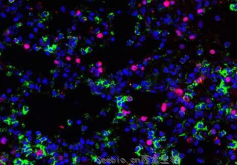 Nat Microbiol：新发现！科学家有望利用脂质靶点开发出新型流感疗法