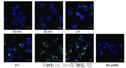 PLoS Pathog：揭示HIV感染如何导致心脏病、糖尿病和痴呆症等一系列慢性疾病