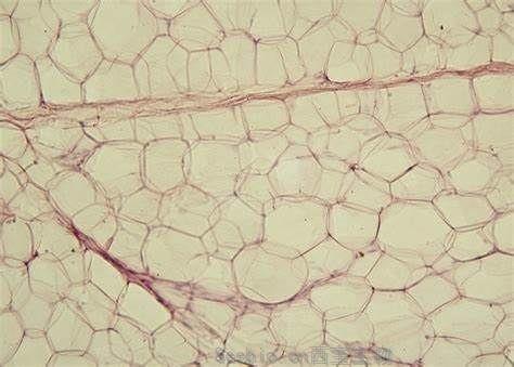 J Clin Endocrinol Metabol：增加体育锻炼并不能改善棕色脂肪组织的功能