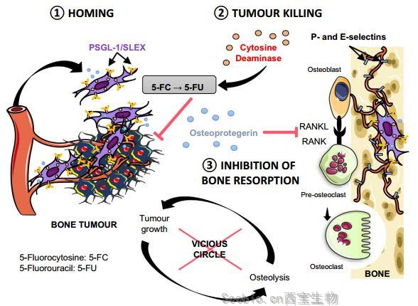 EBioMedicine：研究人员开发出以骨转移为靶点、同时保留骨组织的癌症治疗方法