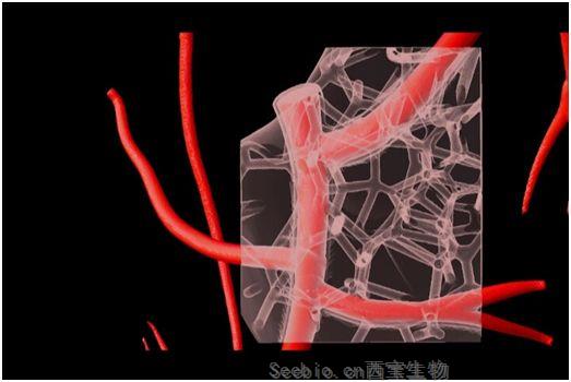 Science：重磅！三维打印人类心脏不再是遥远的梦