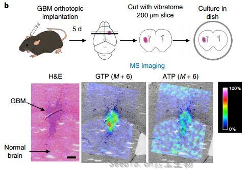 Nat Cell Biol：研究揭示肿瘤生长的核心——癌细胞的进食机制