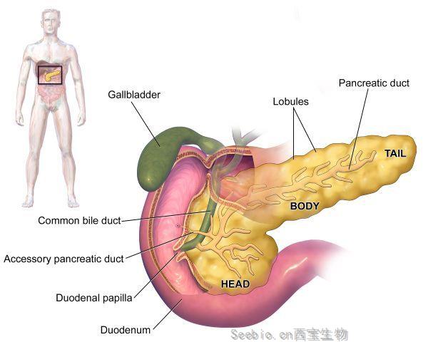 Cell Metab意外发现：<font color='red'>胰腺癌</font>可能是胰岛素水平过高导致！