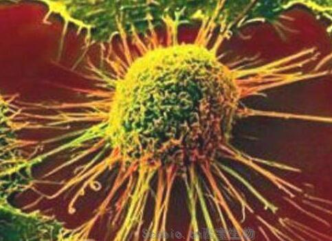 Nat Commun：乳腺癌中的基因突变或有望帮助开发治疗肺癌的新型疗法