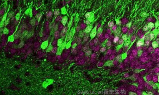 Nat Neurosci：独特的指纹印记或让神经细胞变得与众不同