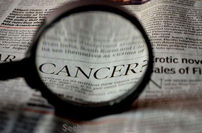 Cancer Res：科学家们在胰腺癌中发现了“抑<font color='red'>癌细胞</font>”