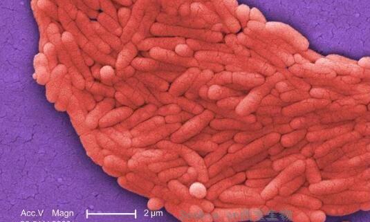 PNAS：揭示机体<font color='red'>免疫系统</font>抵御沙门氏菌感染的分子机制