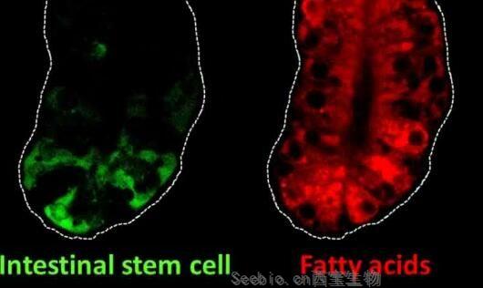 Gastroenterology：关键的肠道干细胞基因或能将膳食脂肪与结肠癌风险联系起来