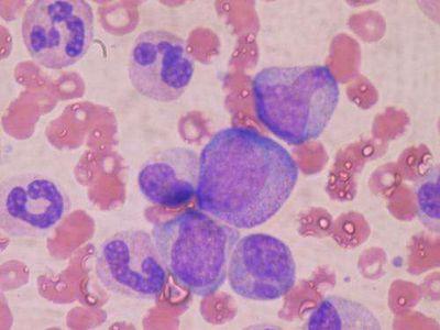 Cell Stem Cell：造血干细胞有助于提高<font color='red'>骨髓</font>移植效率