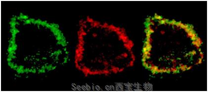 Science子刊：树突细胞决定着PD-L1阻断<font color='red'>癌症</font>免疫疗法的疗效