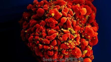 Science子刊：揭示异基因造血干<font color='red'>细胞移植</font>后存在HIV重新感染的脆弱窗口