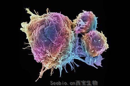 Nature Cancer 阻断肿瘤信号可以阻止癌症的扩散