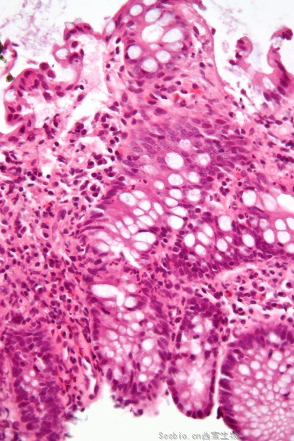 Cell：出乎意料！口腔微生物隐藏着肠道疾病的治疗方法！