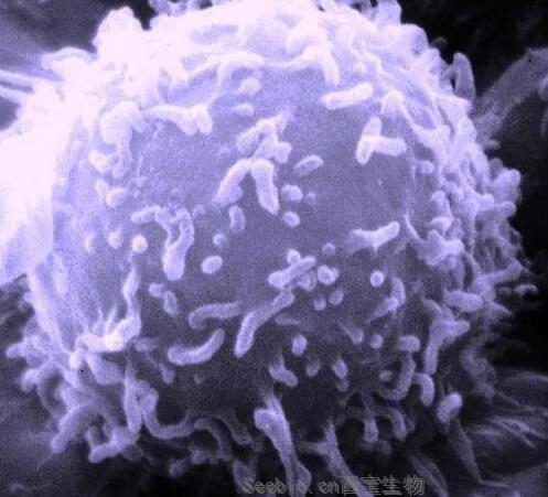 Cancer Res：不可思议！生长激素水平的升高或会增加机体患多种癌症的风险！