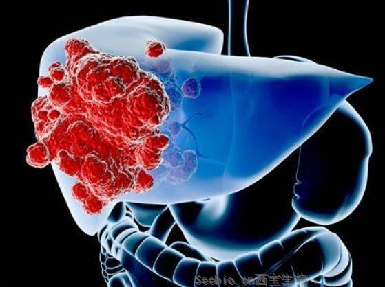 Nature子刊解读！科学家们开发出能高效检测人类脂肪肝和肝纤维化新型探测器！