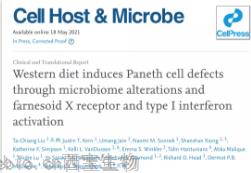 Cell子刊：肠道炎症、感染的原因找到了，都是披萨汉堡惹的祸！