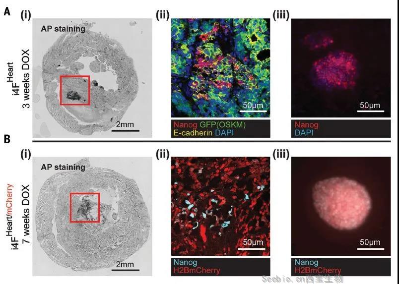 Science重磅：局部重编程让心肌细胞“返老还童” 让心脏实现再生！