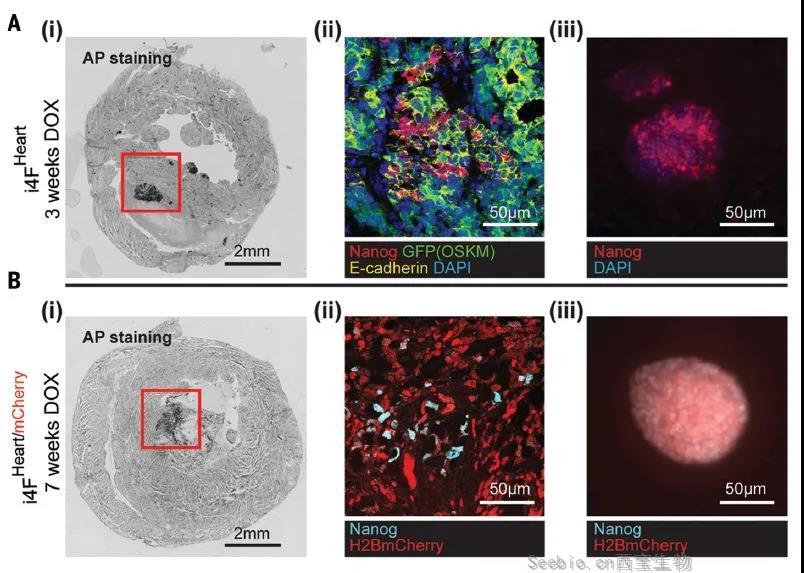 Science重磅：局部重编程让心肌细胞“<font color='red'>返老还童</font>” 让心脏实现再生！