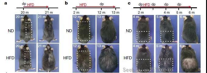 Nature：远离高脂饮食！脂肪不仅会让你长胖，还会让你变秃