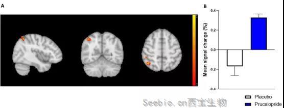 牛津科学家发现：通便也能通记忆，这种药物或可打造“最强大脑”