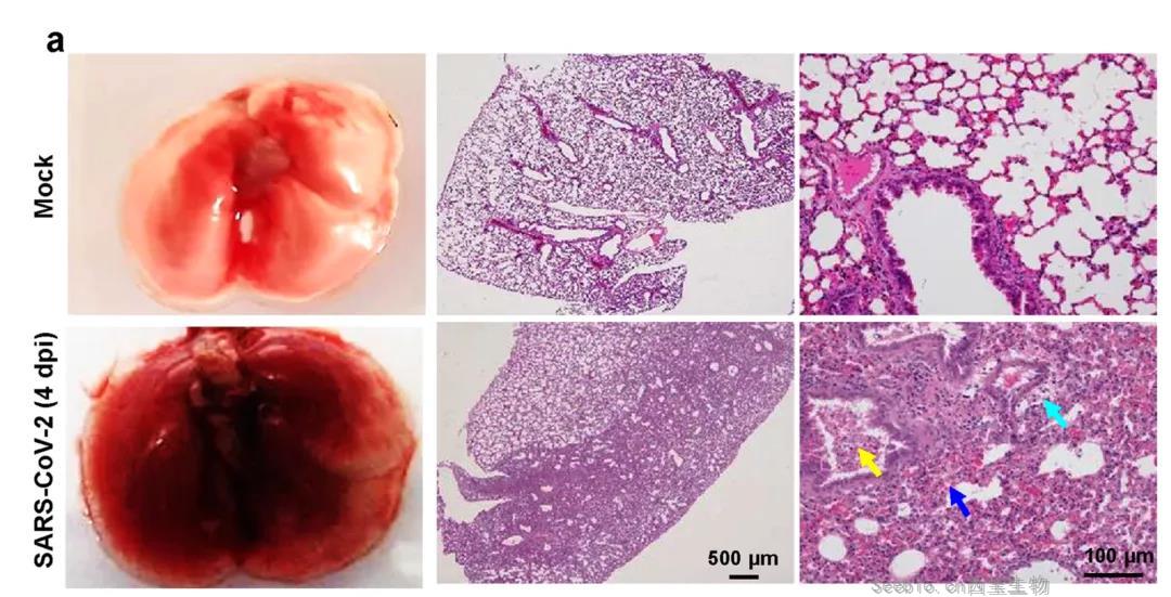 建模成功！Nature子刊：成功建立新冠肺炎重症模型，揭示<font color='red'>新冠病毒</font>感染的分子机制