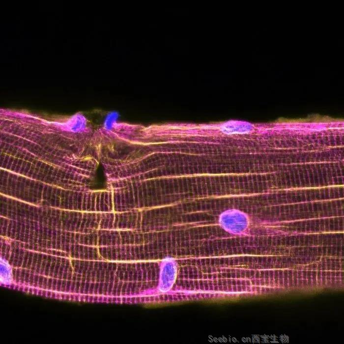 撸铁过猛<font color='red'>肌肉酸痛</font>？别担心，Science揭示受损肌肉自我修复的秘密