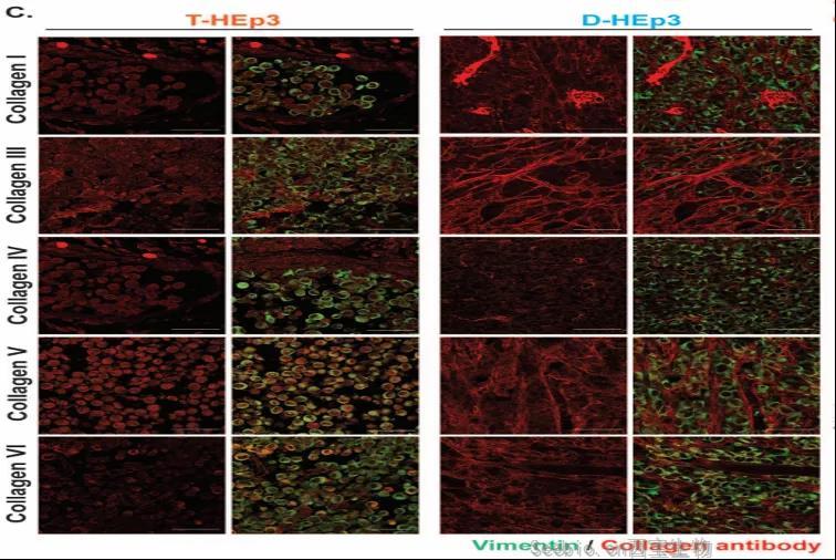 让癌细胞“一睡不醒”！向<font color='red'>肿瘤</font>微环境中添加III型胶原蛋白可防止<font color='red'>肿瘤</font>复发和转移
