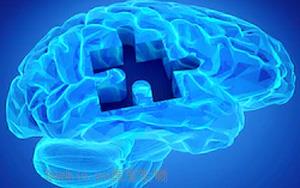阿尔兹海默与表观遗传之间的联系，干预“神经病”取得新进展