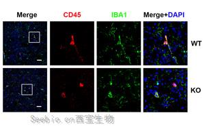 修改<font color='red'>mRNA</font>或可治疗阿尔茨海默病