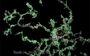 Nature子刊：血管周围细胞诱发阿尔茨海默病相关的微胶质功能障碍