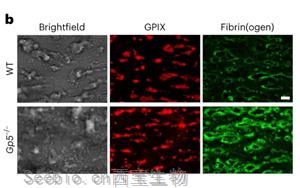 Nature子刊发现全新<font color='red'>机制</font>：新的凝血调节<font color='red'>机制</font>