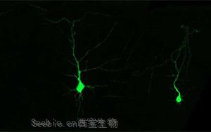 《Cell》发育中的神经细胞利用必需氨基酸的机制