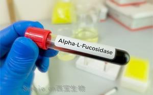 α-L-<font color='red'>岩藻糖</font>苷酶（AFU）检测试剂盒用原辅料