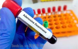 腺苷脱氨酶（ADA）检测试剂盒用原辅料