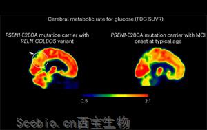 Nature Medicine发现了新的基因变异，可以预防<font color='red'>阿尔茨海默病</font>