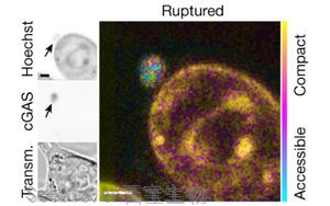 Nature发现染色体不稳定性和表观遗传改变之间意想不到的联系