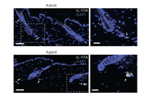 <font color='red'>IL-17</font>蛋白对皮肤老化的关键作用