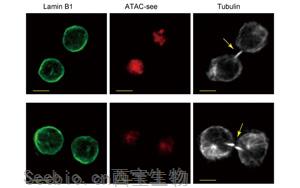 是什么决定了CD8+ <font color='red'>T细胞</font>的命运？Immunity新研究指向cBAF复合物