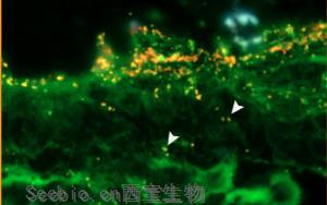 PNAS新研究：致病菌利用肠道黏液层中的一种糖来感染肠道