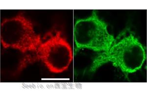 《PNAS》从过度反应蛋白合成到<font color='red'>认知障碍</font>，敲除1个基因即可