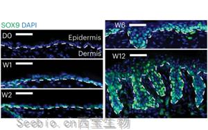 Nature子刊新研究为<font color='red'>癌症</font>如何破坏干细胞精心调整的表观过程提供了新见解