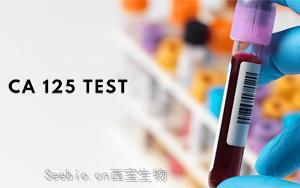 糖类抗原125(CA125)-磁微粒化学发光（<font color='red'>吖啶酯</font>）解决方案