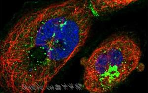 《Cell》有潜力战胜阿尔茨海默氏症的蛋白质，还能延长寿命
