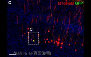 《Neuron》科学家发现脑力更新的<font color='red'>生物标志物</font>