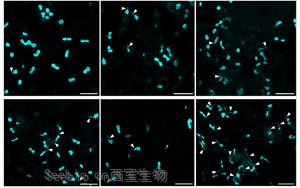 Science Advances：叶绿体的作用不仅仅是光合作用！免疫防御中隐藏的玩家