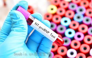 氨基末端脑利钠肽前体（NT-proBNP）-<font color='red'>荧光免疫层析解决方案</font>