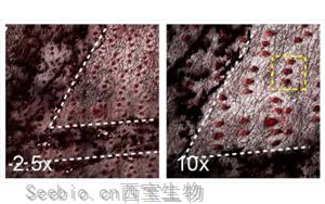 Nature新研究解释了为什么癌基因突变的细胞可以在正常的人体组织中存在